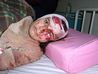 Nada_Adman_skull_fracture.jpg