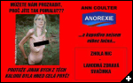 [anorexia1]