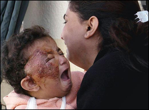 [burnt_baby.jpg]